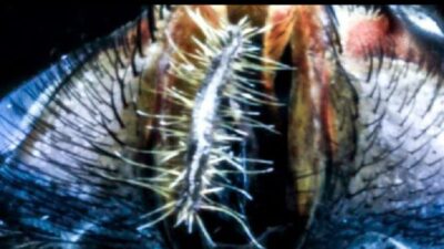 ABD Sağlık Bakanlığı yetkilileri, ülkede ilk kez bir insanda et