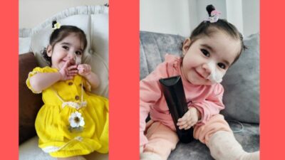 SMA Tip-1 hastası 1 yaşındaki Aysima Durmuş’un hayati tedavisi için