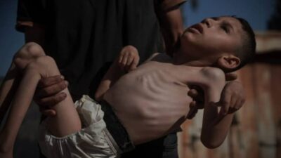 İsrail’in Gazze Şeridi’ne yönelik süren saldırıları ve uyguladığı abluka nedeniyle