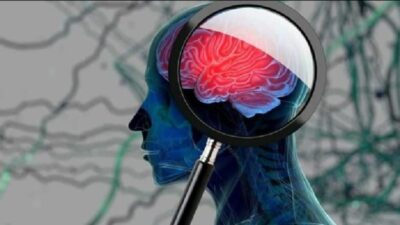 Nöroloji Uzmanı Doç. Dr. Remzi Yiğiter, Alzheimer hastalığının demansa neden