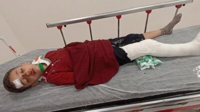 İstanbul Başakşehir’de ailesiyle birlikte vakit geçiren 8 yaşındaki çocuğa, trafiğe