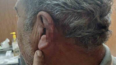 Denizli’nin Acıpayam ilçesinde aile hekimi ile emekli öğretmen arasında yaşanan