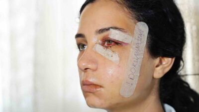 Adana’da eski eşini dövdükten sonra gözaltına alınıp serbest bırakılan şahıs,