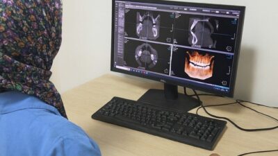 Eskişehir Ağız ve Diş Sağlığı Hastanesi’ne kazandırılan modern diş tomografi