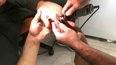 Mardin’in Derik ilçesinde bir kişinin parmağına sıkışan yüzük, hastanede itfaiye