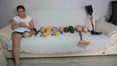 Antalya’da 13 günlükken sol bacağı kesilen ve babasının evin tavanına