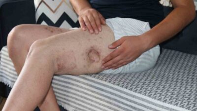 Eskişehir’de akrabası tarafından tüfekle vurulan 30 yaşındaki adam, ilk verdiği