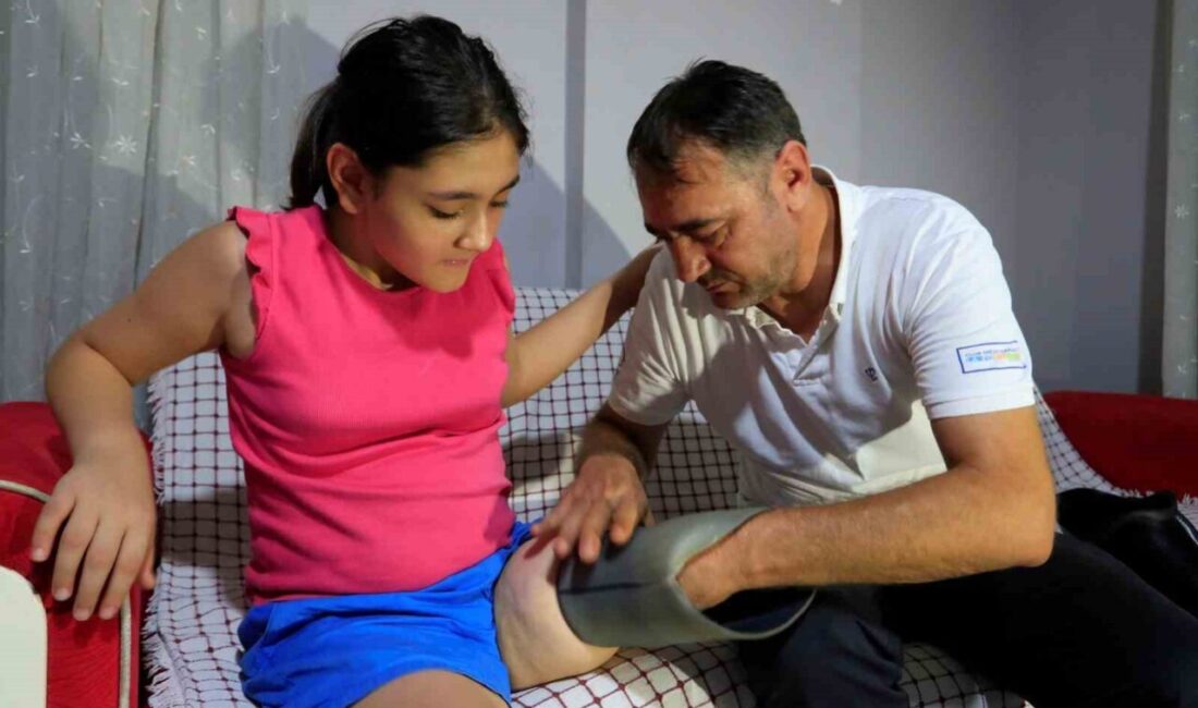 Protez bacağı dar gelen Özge için Türkiye ayağa kalktı Küçük yaşta sol bacağı kesilen ve babasının evin tavanına kurduğu