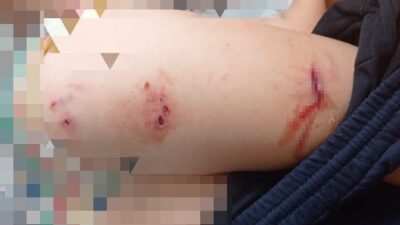 DİYARBAKIR (İHA) – Diyarbakır’da sokak köpeklerinin saldırısı sonucu 9 yaşındaki