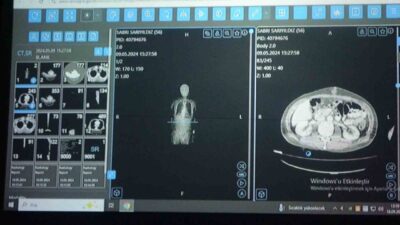 Sağlık Bilimleri Üniversitesi (SBÜ) Van Bölge Eğitim ve Araştırma Hastanesi’nde