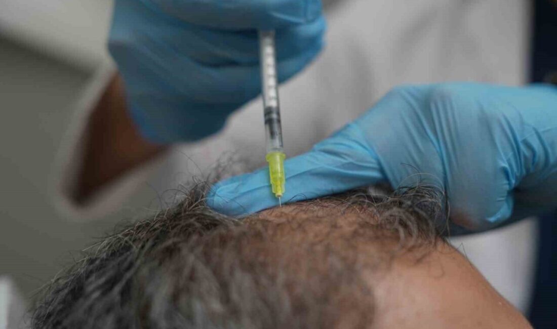 Toplumda yaygın görülen saç dökülmesinin vücudun verdiği önemli bir “sağlık