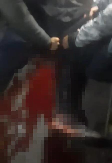 Üsküdar’da yüksek sesli müzik kavgasında bir kişi bıçaklandı. Yaralı olay