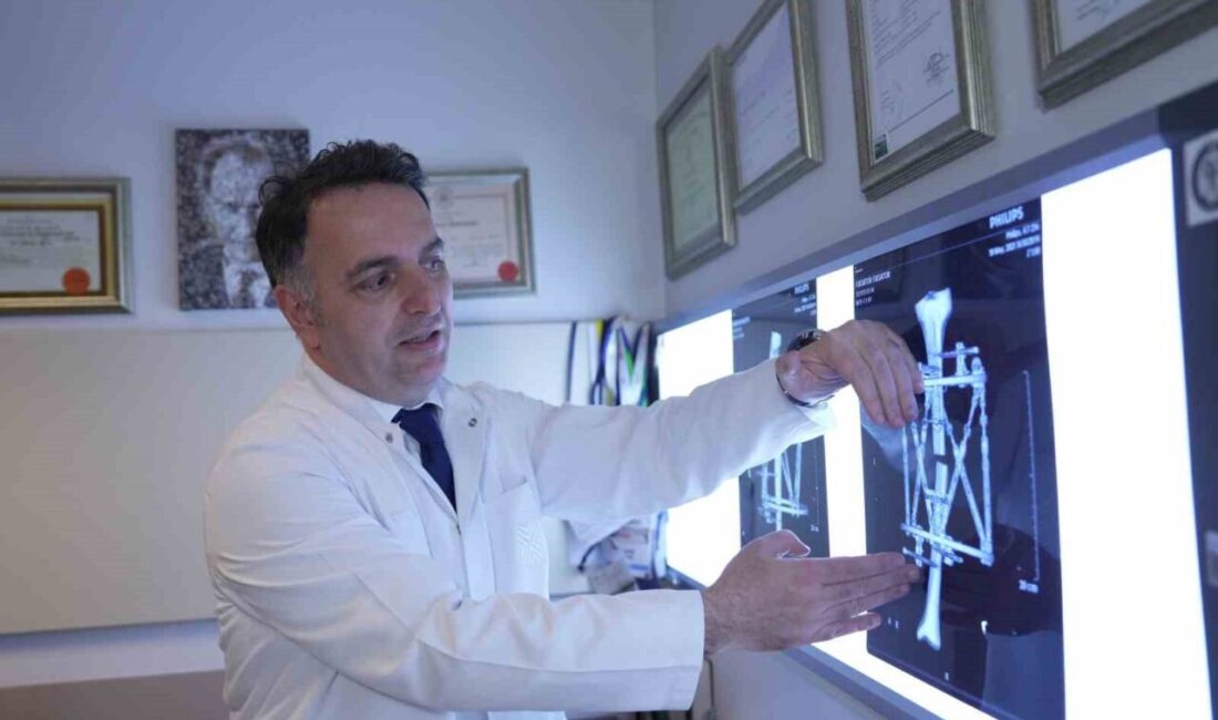 Kemik deformiteleri ve boy kısalığı, bireyleri sadece fiziksel değil, psikolojik